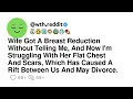 Wife Got A Breast Reduction Without Telling Me And Now I m Struggling With Her Flat Chest And Sc