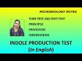 Indole production test Tube test and Spot test Principle Procedure and Observations English