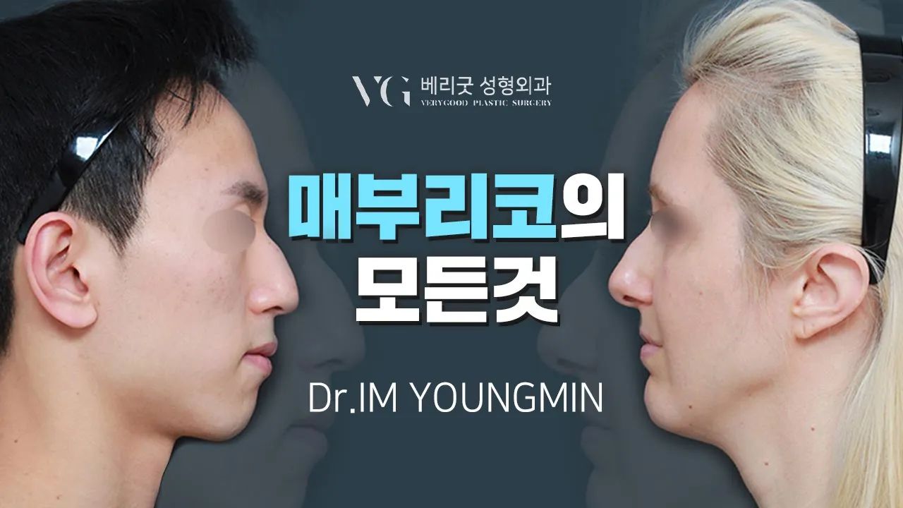 #임영민원장 매부리코에 대한 모든것!👃매부리타입부터 수술 방법까지 쉽게 설명듣자!👌 매부리교정 마녀코 코수술 매부리수술 매부리성형