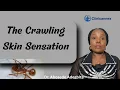 The Crawling Skin Sensation Formication