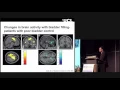Jalesh Panicker - What is Urinary Urgency and How Should It Be Measured