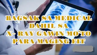 bagsak sa medical dahil sa x ray may solusyon para makapasa ito ang dapat mong gawin