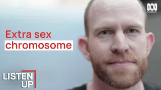  i was born with an extra chromosome 