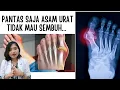 Download Lagu 3 PENYEBAB ASAM URAT SULIT SEMBUH DAN SOLUSINYA | dr.Emasuperr
