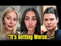 20 Celebrity Plastic Surgery Disasters In Their Own Words Then Now 2026