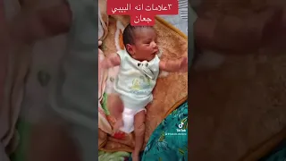 علامات الجوع الشديد عند الرضيع Babies Doctora يوميات دكتوره اطفال Baby 