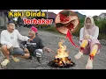 Download Lagu GAWAT!!! KAKI DINDA KEBAKAR SAMPAI KELUAR DARAH