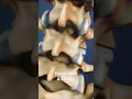 Facet Joint Anatomy