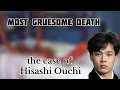 The Tragic Case of Hisashi Ouchi A Living Nightmare