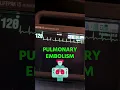 Download Lagu EMS Treatment of Sinus Tachycardia