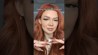 Getting My Lip Fillers Dissolved 