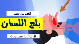 بلع اللسان عند لاعبين كرة القدم كيف تنقذ حالات انسداد مجرى التنفس 