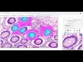 Quick Annotator A Tool for Rapidly Annotating Digital Pathology Images