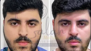 نتيجه مباشره من داخل غرفه العمليات دكتور محمد صلاح عبد العظيم 