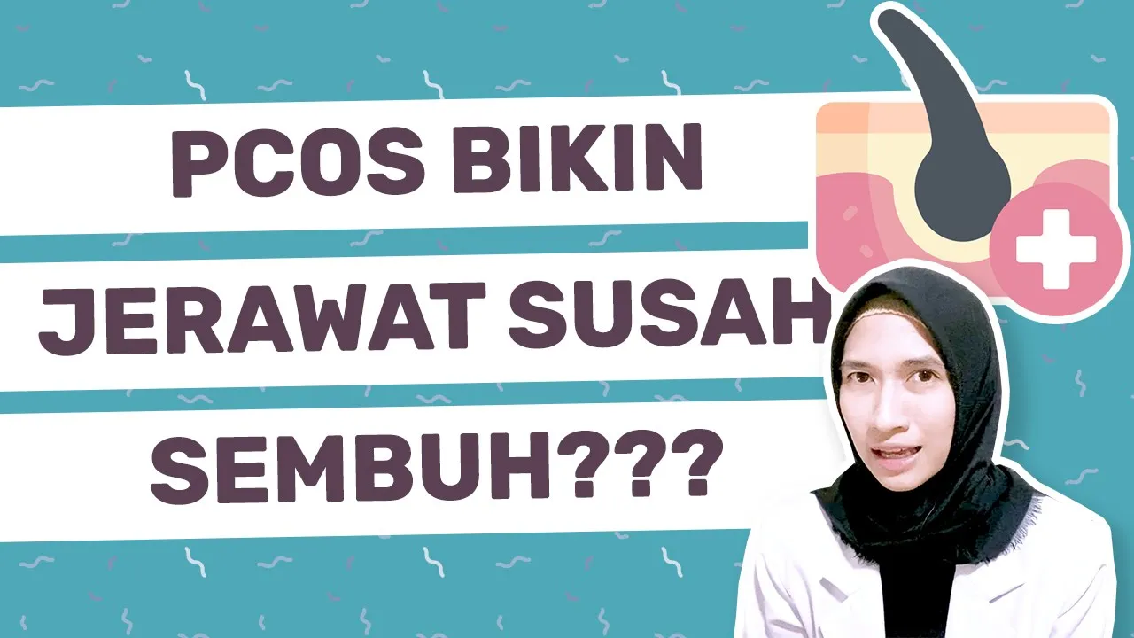 
          
          
          
            
            Kenapa Jerawat Susah Sembuh? Jangan-jangan... PCOS? | dr. Vania Utami
          
        . 