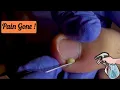 Download Lagu Satisfacción Total con Esta Limpieza de Uñas 🫣