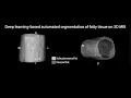 Neural Networks for Adipose Tissue Segmentation on Magnetic Resonance Images 2022-088