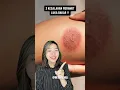 Download Lagu TIPS MERAWAT LUKA BAKAR! #skincaretips #aestheticdoctor #lukabakar #skintips