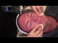 Watch a Med Spa Facial at Dermatology Associates of Rochester