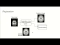 6 0 - MRI image registration with ANTsPy