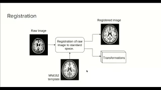 6 0 - MRI image registration with ANTsPy