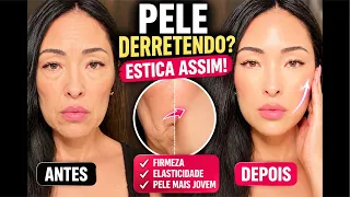 PELE DERRETENDO? ESTICA ASSIM!