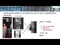 Artificial Intelligence in Knee Osteoarthritis Diagnostic