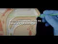 COVID-19 Specimen Collection Nasopharyngeal NP Specimens Only - updated April 12 2020
