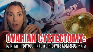 ovarian cystectomy what to expect before during u0026 after ovarian cyst surgery