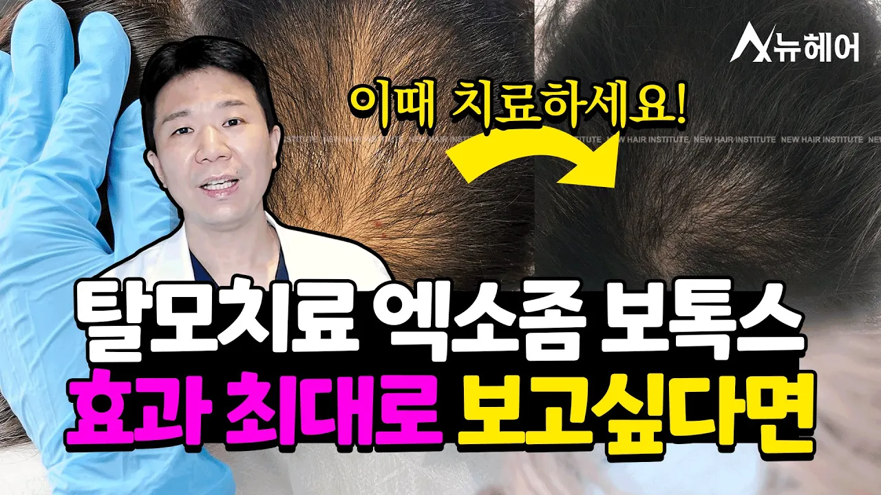 엑소좀 보톡스 최대 효과 보고 싶다면 봐야 할 영상ㅣ뉴헤어