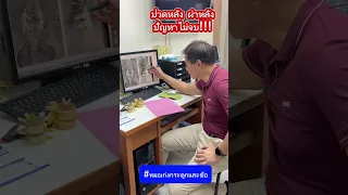 ทำไมคนที่ผ่าตัดกระดูกสันหลังแล้ว ถึงอาจมีอาการปวดหลังกลับมาได้ในอนาคต