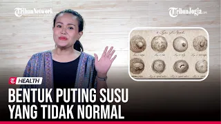  bagaimana bentuk puting susu yang tidak normal 