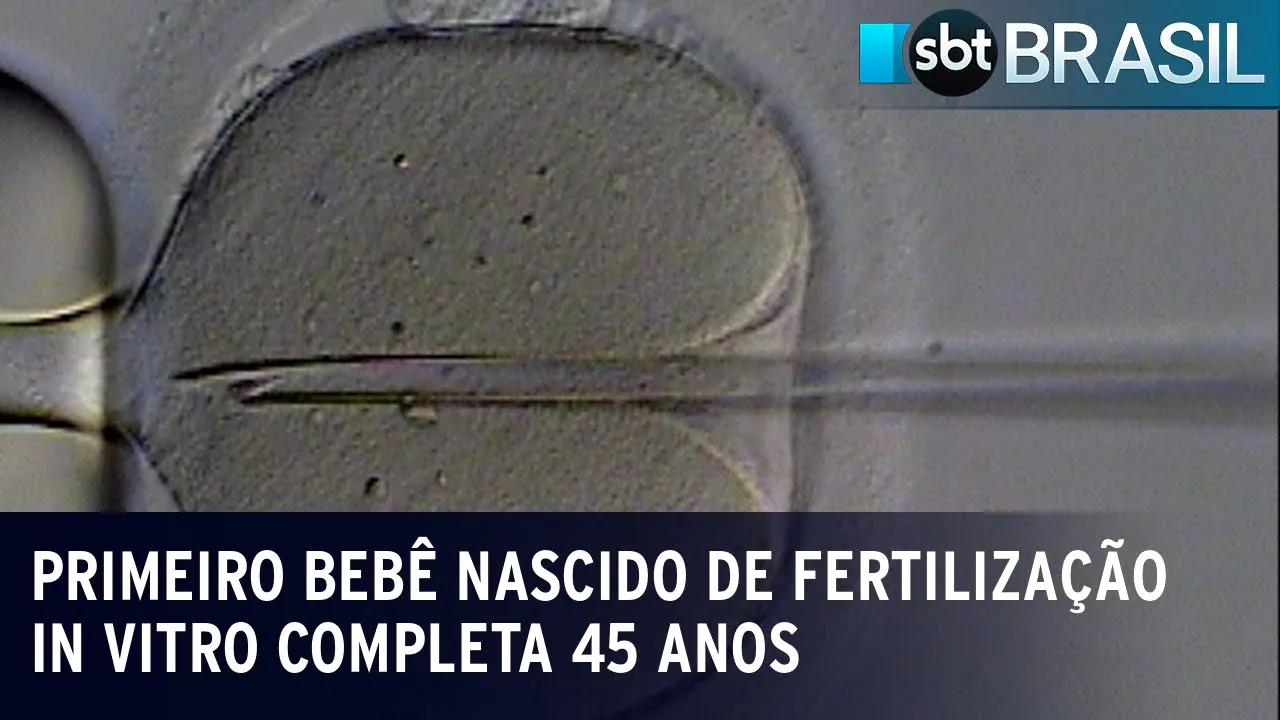 Técnica Fertilização in Vitro completa 45 anos; veja avanços | SBT Brasil (02/08/23)