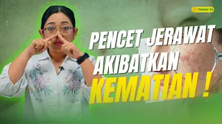 Dokter 24 - Pencetin Jerawat Bikin Meninggal?