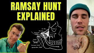 Download Doctor explains Ramsay Hunt syndrome (as seen with Justin Bieber) causing facial nerve paralysis... MP3