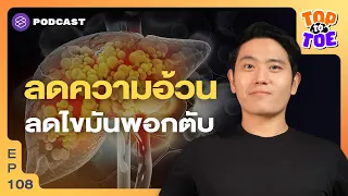 จะรู้ได้อย่างไรว่ามีไขมันพอกตับ เพราะอาการมักไม่ชัดเจน