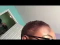 Dying My 4c Hair Burgundy No Bleach