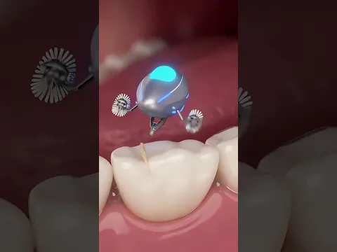 The Entire Process of Millimeter-Sized Future Microbots Cleaning Between Teeth!