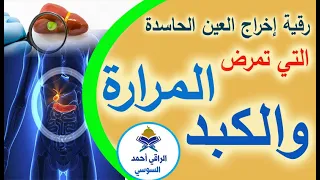 إخراج العين من الكبد والمرارة في دقائق بإذن الله Ruqyay 