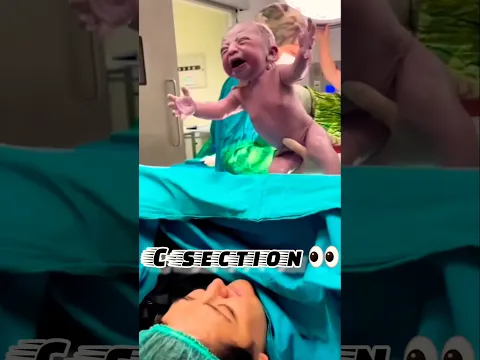 A Newborn Babyโs First Moments of Love โค๏ธ | C-Section Birth ๐ #mom #baby #family #shorts