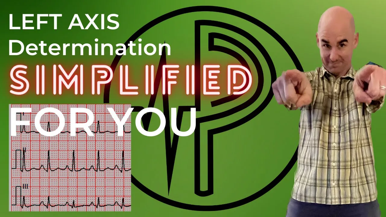 Left Axis Deviation Simplified for YOU!!!
