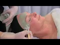 New Skin BEAUTY ON ROSE ESSENDON MELBOURNE