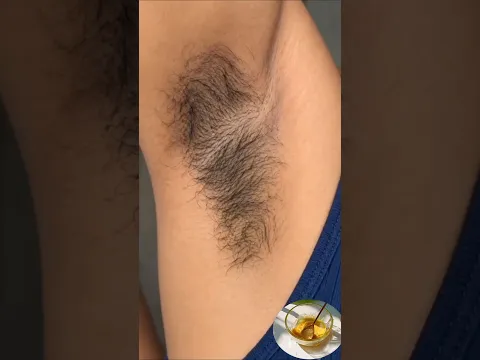 Remove Underarms Hair Naturally #beauty #shorts #beautytips #skincare #homeremedies