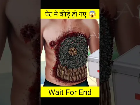 Download MP3 पेट मे कीड़े हो गए 😱| got stomach worms| 3d animation| #youtube #shorts