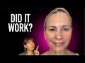 I Used This Laser Device for 8 Weeks Here s What Happened