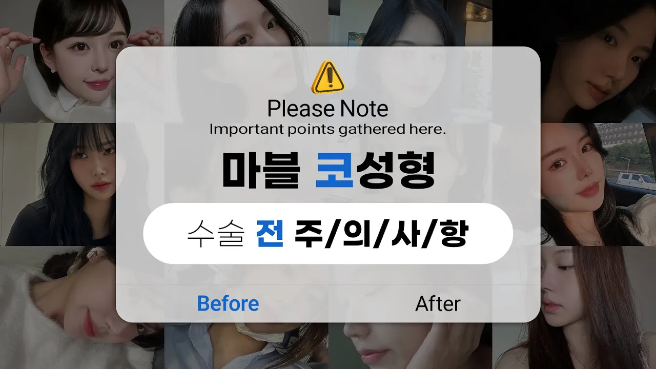 [코성형] 📌 코수술 전 꼭 알아야 할 주의사항 총정리 📌