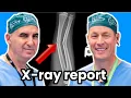 Knee X-rays 101 How To Interpret Your X-ray Report