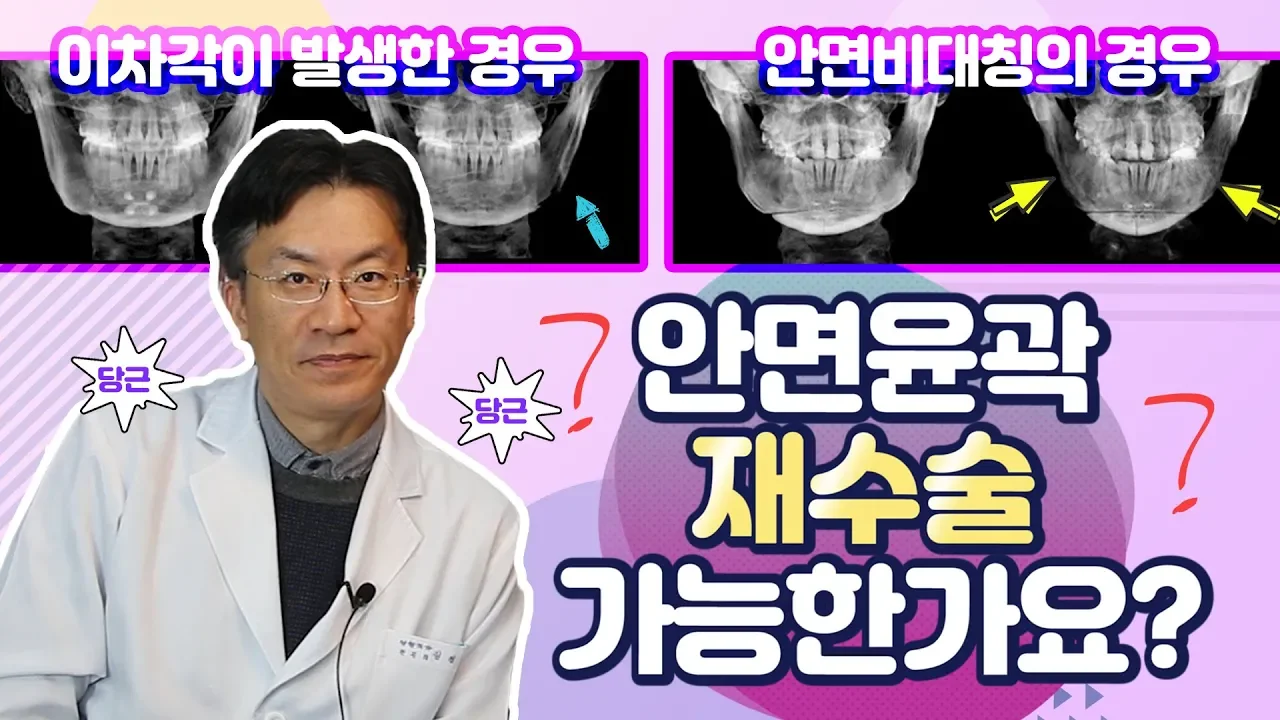 (ENG/CN SUB)  [안면윤곽 편] Ep5 안면윤곽 재수술이 가능한가요?/ 안면윤곽 재수술에 관한 모든것 물어보세요!