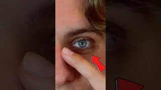 تخلص من الهالات السوداء فورا 