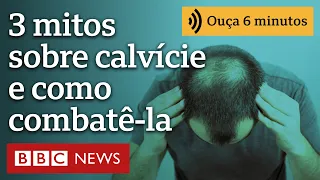 3 mitos sobre a calvície e como combatê-la, segundo especialista